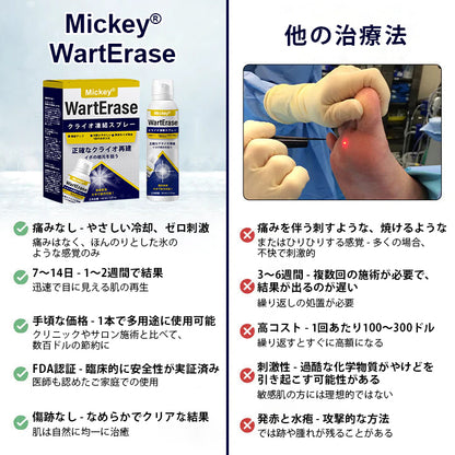 ❄️Mickey®WartErase – 冷凍イボ除去スプレー