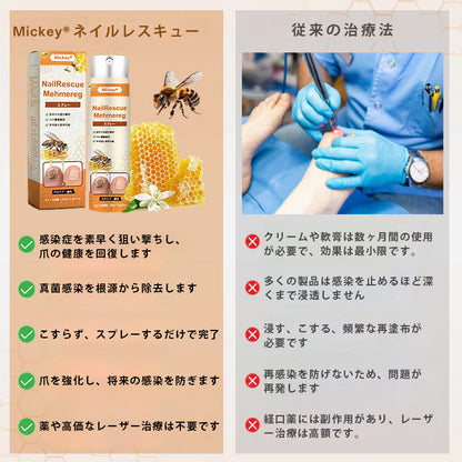 🌿Mickey® ネイルレスキュー ビーポイズン スプレー