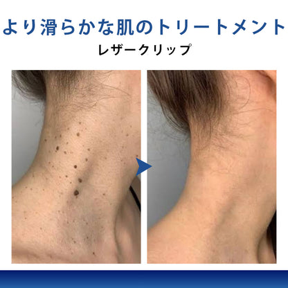 🫘Mickey® ダブルアクション ハイドロコロイド マイクロニードルパッチ