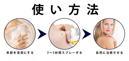 ❄️Mickey®WartErase – 冷凍イボ除去スプレー