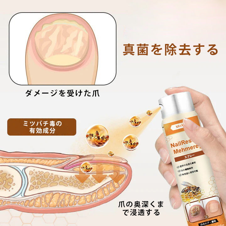 🌿Mickey® ネイルレスキュー ビーポイズン スプレー